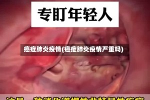 癌症肺炎疫情(癌症肺炎疫情严重吗)