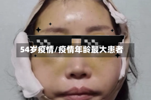 54岁疫情/疫情年龄最大患者