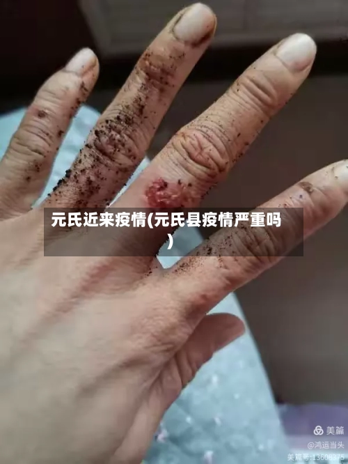 元氏近来疫情(元氏县疫情严重吗)-第2张图片